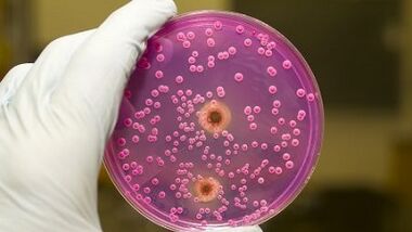 Ang paglabas ng pathological sa mga kalalakihan kapag nasasabik